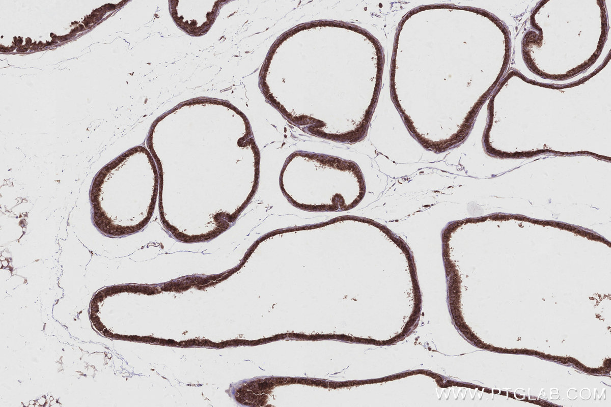 Immunohistochemical analysis of paraffin-embedded mouse prostate tissue slide using KHC2934 (ARFGAP3 IHC Kit).