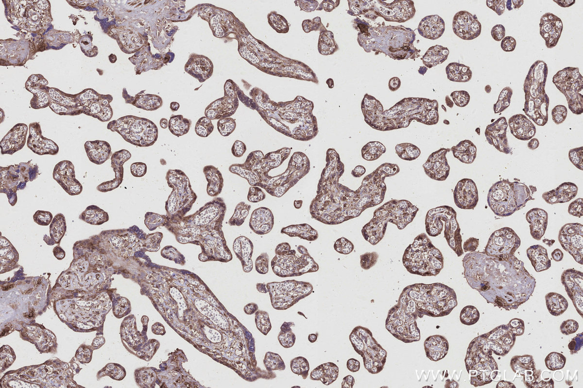 Immunohistochemical analysis of paraffin-embedded human placenta tissue slide using KHC2934 (ARFGAP3 IHC Kit).