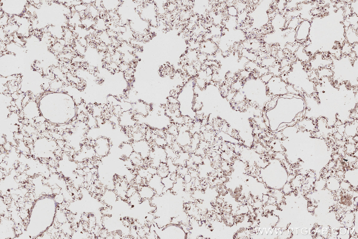 Immunohistochemical analysis of paraffin-embedded rat lung tissue slide using KHC3088 (ARFGEF1 IHC Kit).