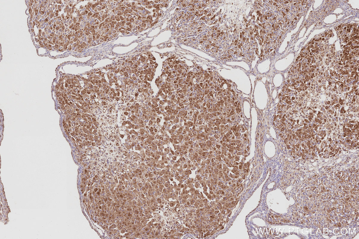 Immunohistochemical analysis of paraffin-embedded rat ovary tissue slide using KHC3088 (ARFGEF1 IHC Kit).