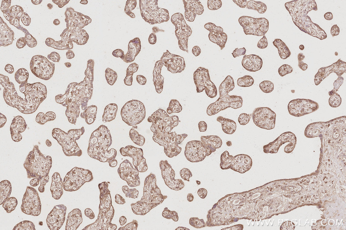 Immunohistochemical analysis of paraffin-embedded human placenta tissue slide using KHC3087 (ARFGEF2 IHC Kit). Immunohistochemical analysis of paraffin-embedded human placenta tissue slide using KHC3087 (ARFGEF2 IHC Kit).