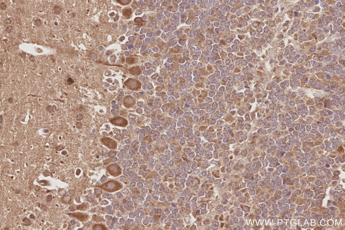 Immunohistochemical analysis of paraffin-embedded mouse cerebellum tissue slide using KHC3087 (ARFGEF2 IHC Kit). Immunohistochemical analysis of paraffin-embedded mouse cerebellum tissue slide using KHC3087 (ARFGEF2 IHC Kit).