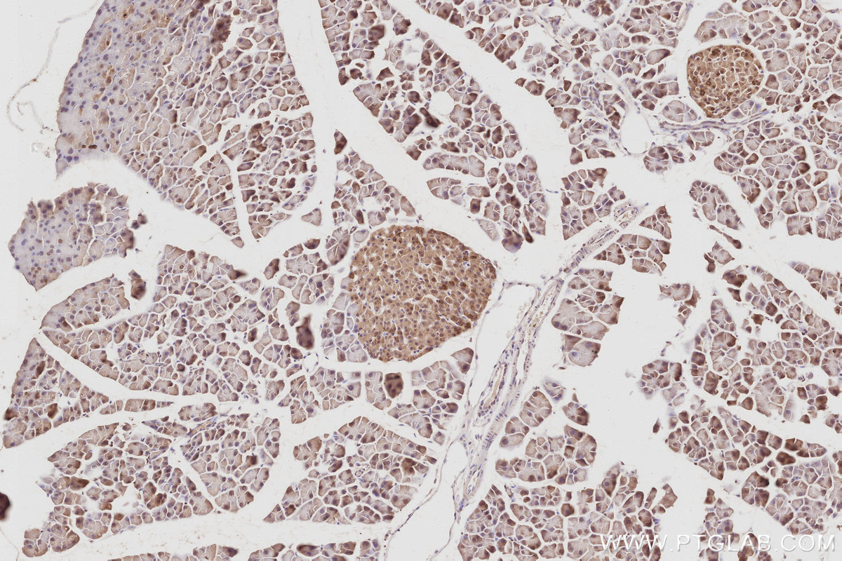 Immunohistochemical analysis of paraffin-embedded mouse pancreas tissue slide using KHC3087 (ARFGEF2 IHC Kit). Immunohistochemical analysis of paraffin-embedded mouse pancreas tissue slide using KHC3087 (ARFGEF2 IHC Kit).
