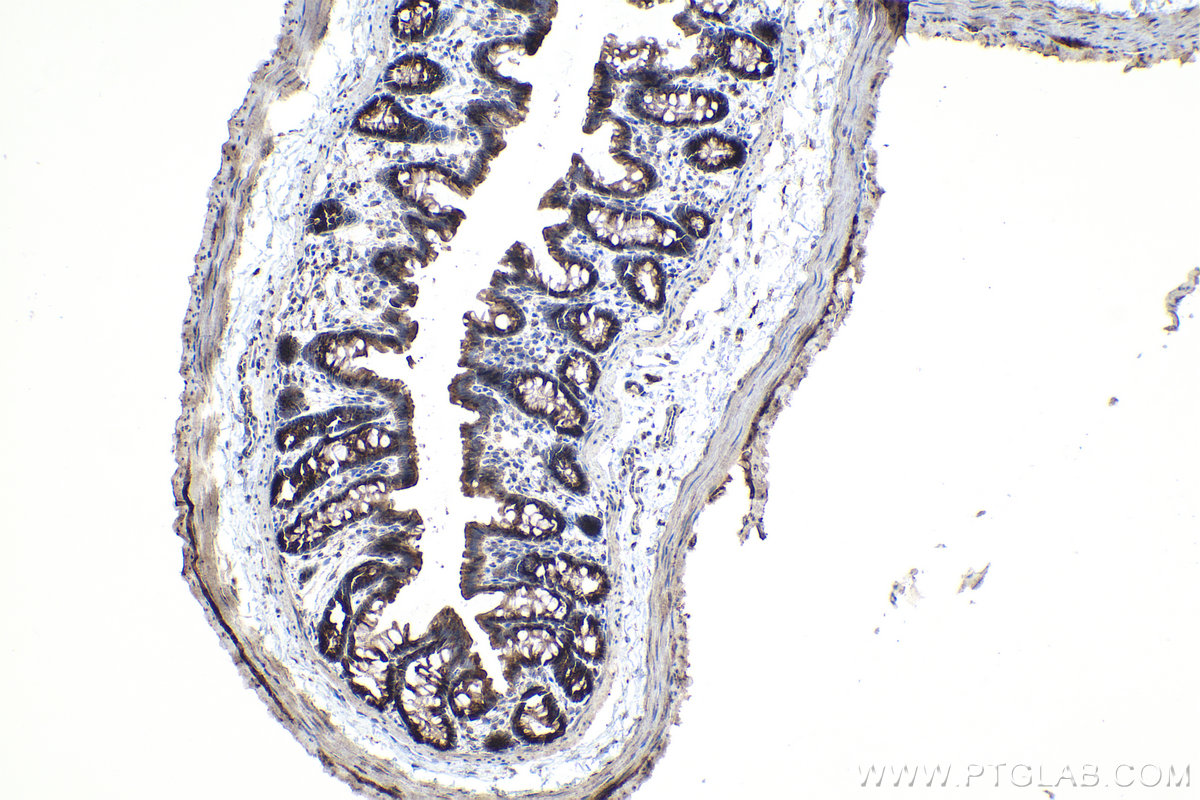 Immunohistochemical analysis of paraffin-embedded rat colon tissue slide using KHC0980 (ARFIP2 IHC Kit).