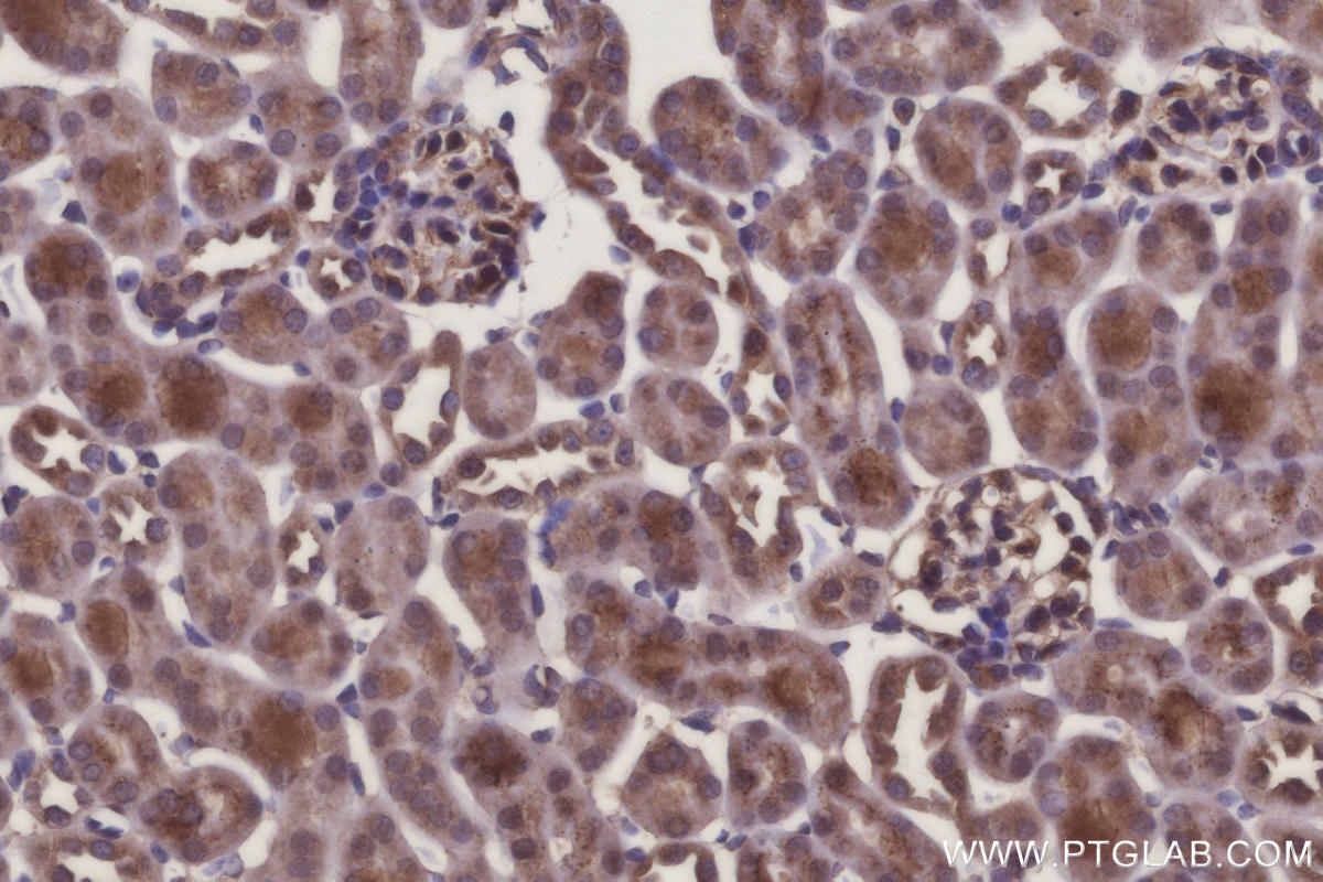 Immunohistochemical analysis of paraffin-embedded mouse kidney tissue slide using KHC3130 (ARHGAP23 IHC Kit).