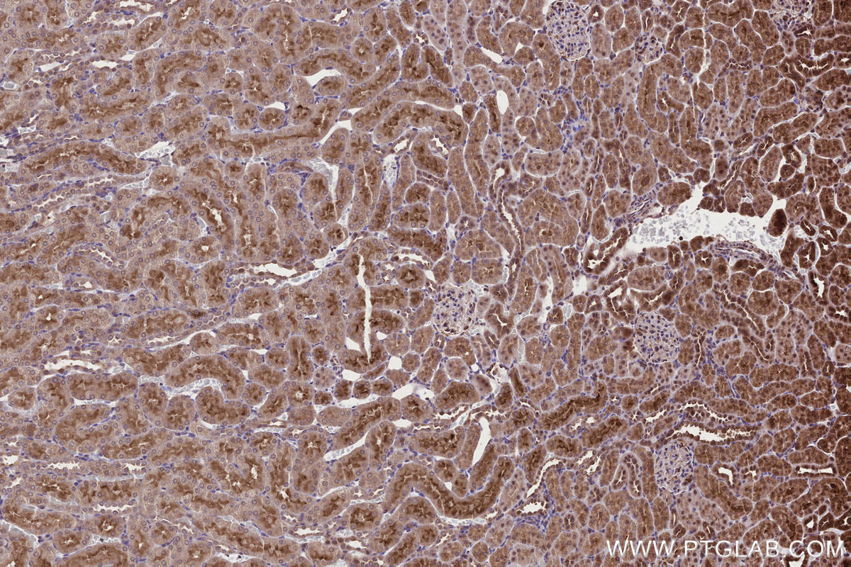 Immunohistochemical analysis of paraffin-embedded rat kidney tissue slide using KHC2669 (ARHGAP24 IHC Kit).