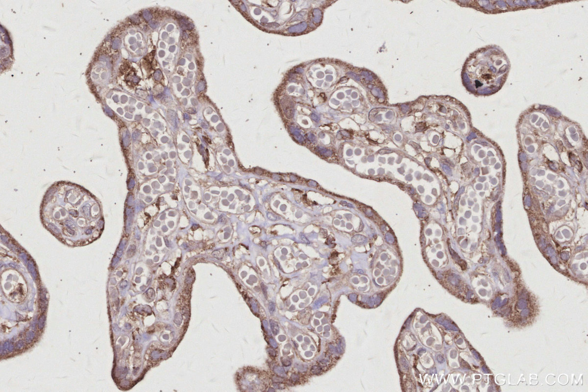 Immunohistochemical analysis of paraffin-embedded human placenta tissue slide using KHC2994 (ARHGAP28 IHC Kit).
