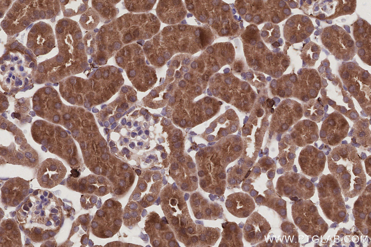 Immunohistochemical analysis of paraffin-embedded mouse kidney tissue slide using KHC2994 (ARHGAP28 IHC Kit).