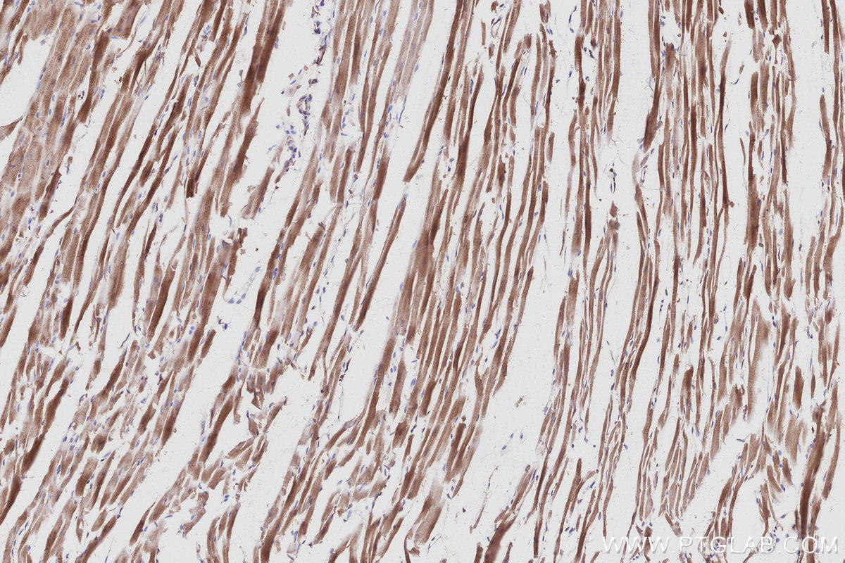 Immunohistochemical analysis of paraffin-embedded rat heart tissue slide using KHC2994 (ARHGAP28 IHC Kit).