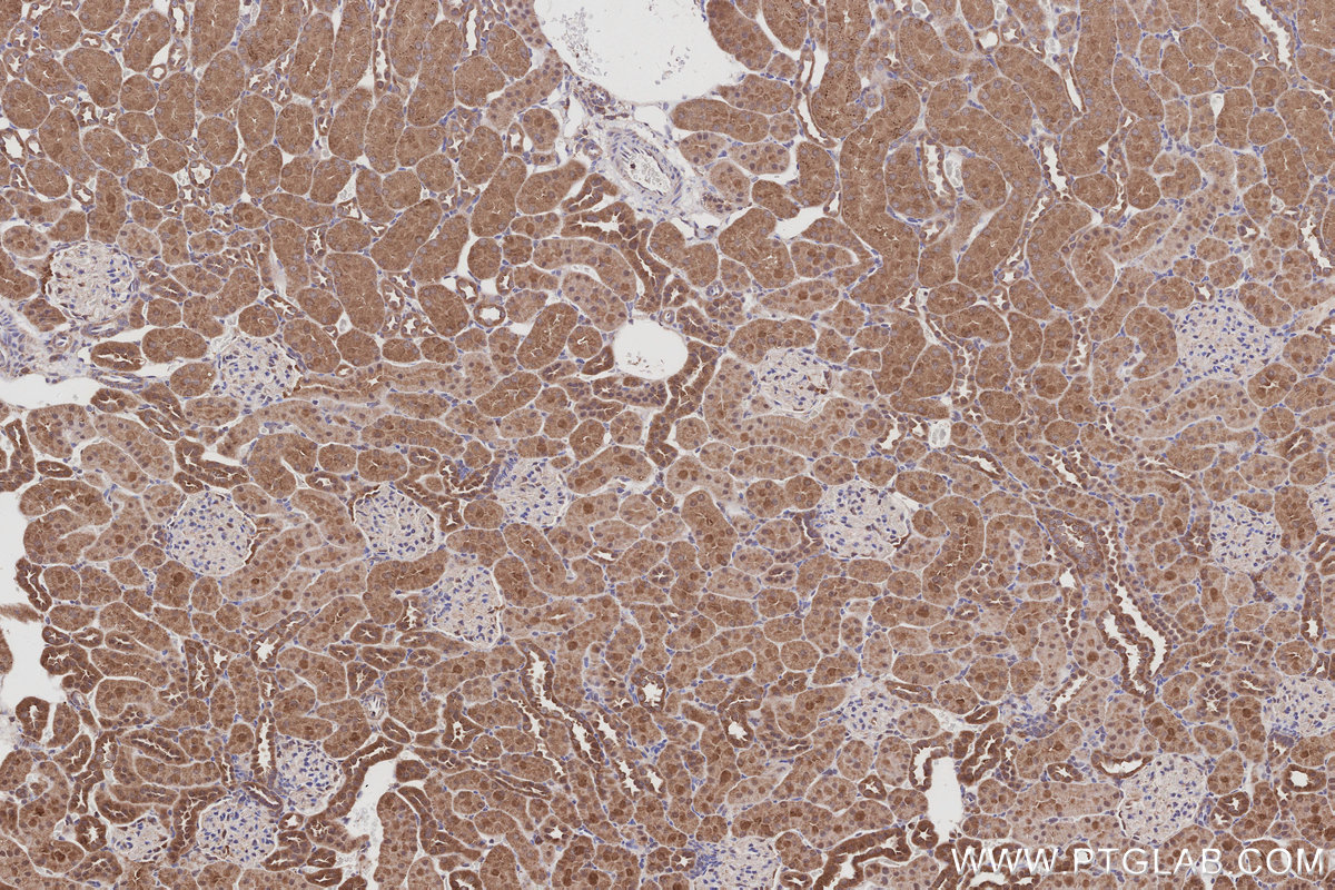 Immunohistochemical analysis of paraffin-embedded rat kidney tissue slide using KHC2994 (ARHGAP28 IHC Kit).