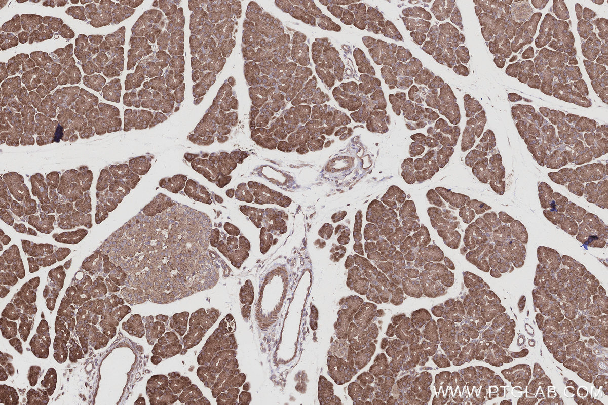 Immunohistochemical analysis of paraffin-embedded rat pancreas tissue slide using KHC2994 (ARHGAP28 IHC Kit).