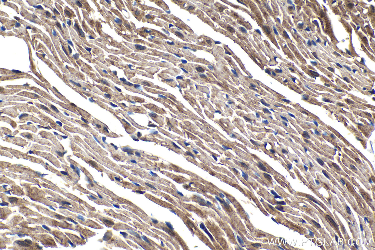 Immunohistochemical analysis of paraffin-embedded mouse heart tissue slide using KHC1494 (ARHGAP29 IHC Kit).