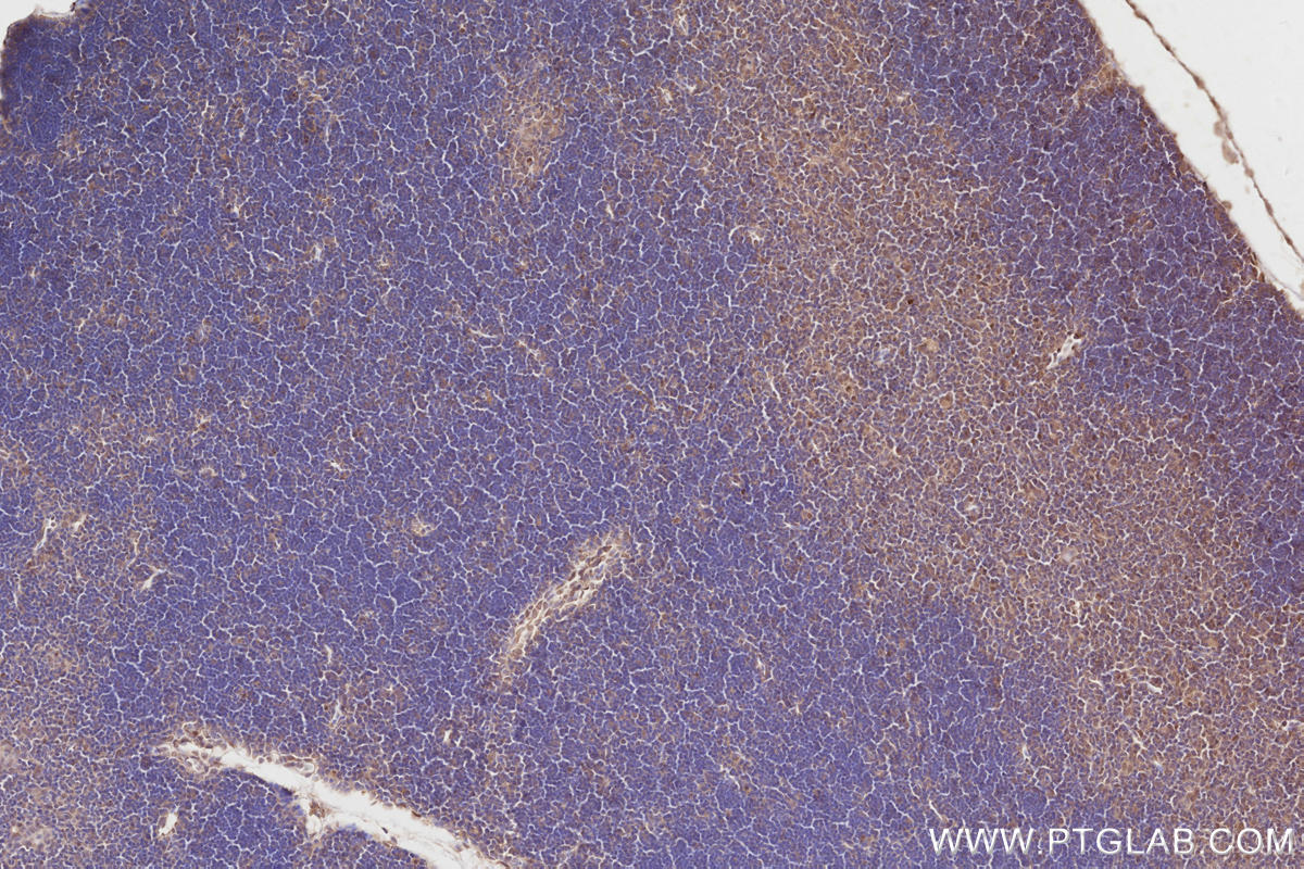 Immunohistochemical analysis of paraffin-embedded mouse thymus tissue slide using KHC2857 (ARHGAP9 IHC Kit).