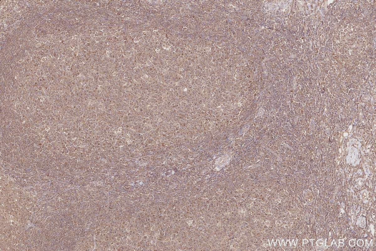 Immunohistochemical analysis of paraffin-embedded human tonsillitis tissue slide using KHC2857 (ARHGAP9 IHC Kit).