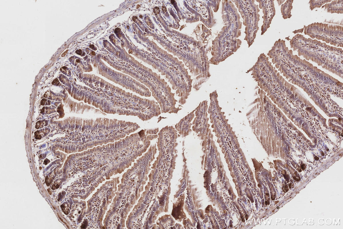 Immunohistochemical analysis of paraffin-embedded mouse small intestine tissue slide using KHC2857 (ARHGAP9 IHC Kit).