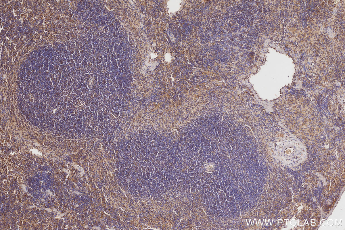 Immunohistochemical analysis of paraffin-embedded mouse spleen tissue slide using KHC2857 (ARHGAP9 IHC Kit).