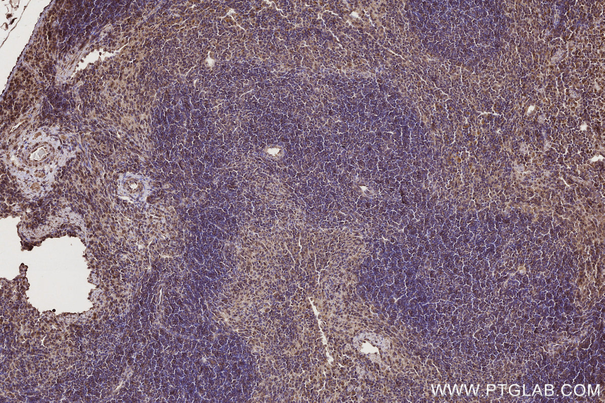 Immunohistochemical analysis of paraffin-embedded mouse spleen tissue slide using KHC2764 (ARHGEF1 IHC Kit). Immunohistochemical analysis of paraffin-embedded mouse spleen tissue slide using KHC2764 (ARHGEF1 IHC Kit).
