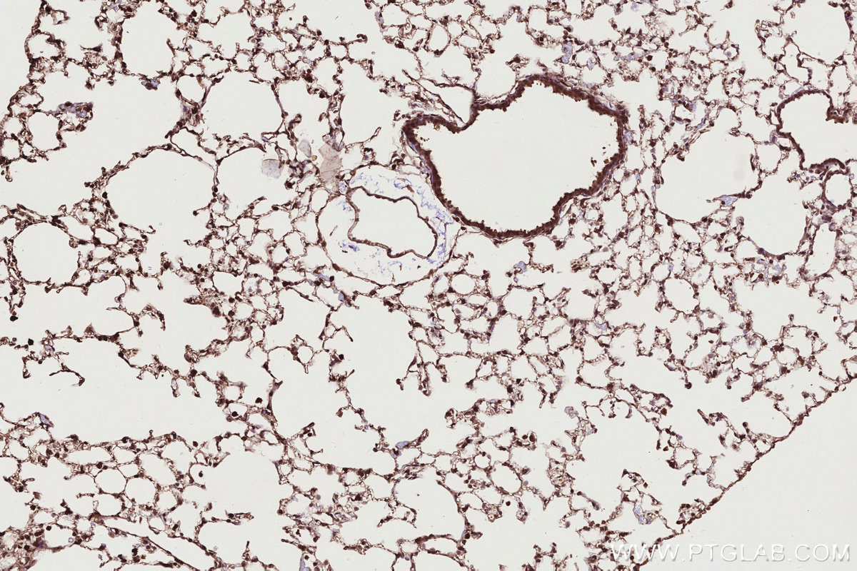 Immunohistochemical analysis of paraffin-embedded mouse lung tissue slide using KHC2764 (ARHGEF1 IHC Kit). Immunohistochemical analysis of paraffin-embedded mouse lung tissue slide using KHC2764 (ARHGEF1 IHC Kit).