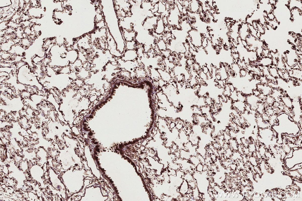 Immunohistochemical analysis of paraffin-embedded rat lung tissue slide using KHC2764 (ARHGEF1 IHC Kit). Immunohistochemical analysis of paraffin-embedded rat lung tissue slide using KHC2764 (ARHGEF1 IHC Kit).