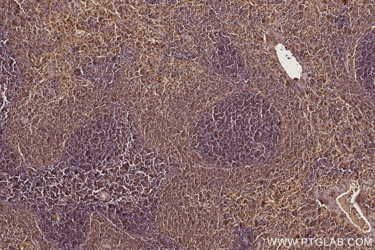 Immunohistochemical analysis of paraffin-embedded rat spleen tissue slide using KHC2764 (ARHGEF1 IHC Kit). Immunohistochemical analysis of paraffin-embedded rat spleen tissue slide using KHC2764 (ARHGEF1 IHC Kit).