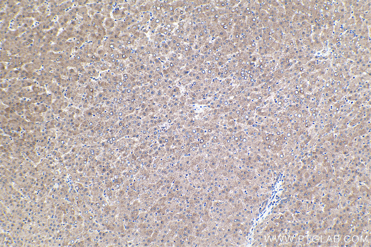 Immunohistochemical analysis of paraffin-embedded human liver tissue slide using KHC1690 (ARHGEF5 IHC Kit).