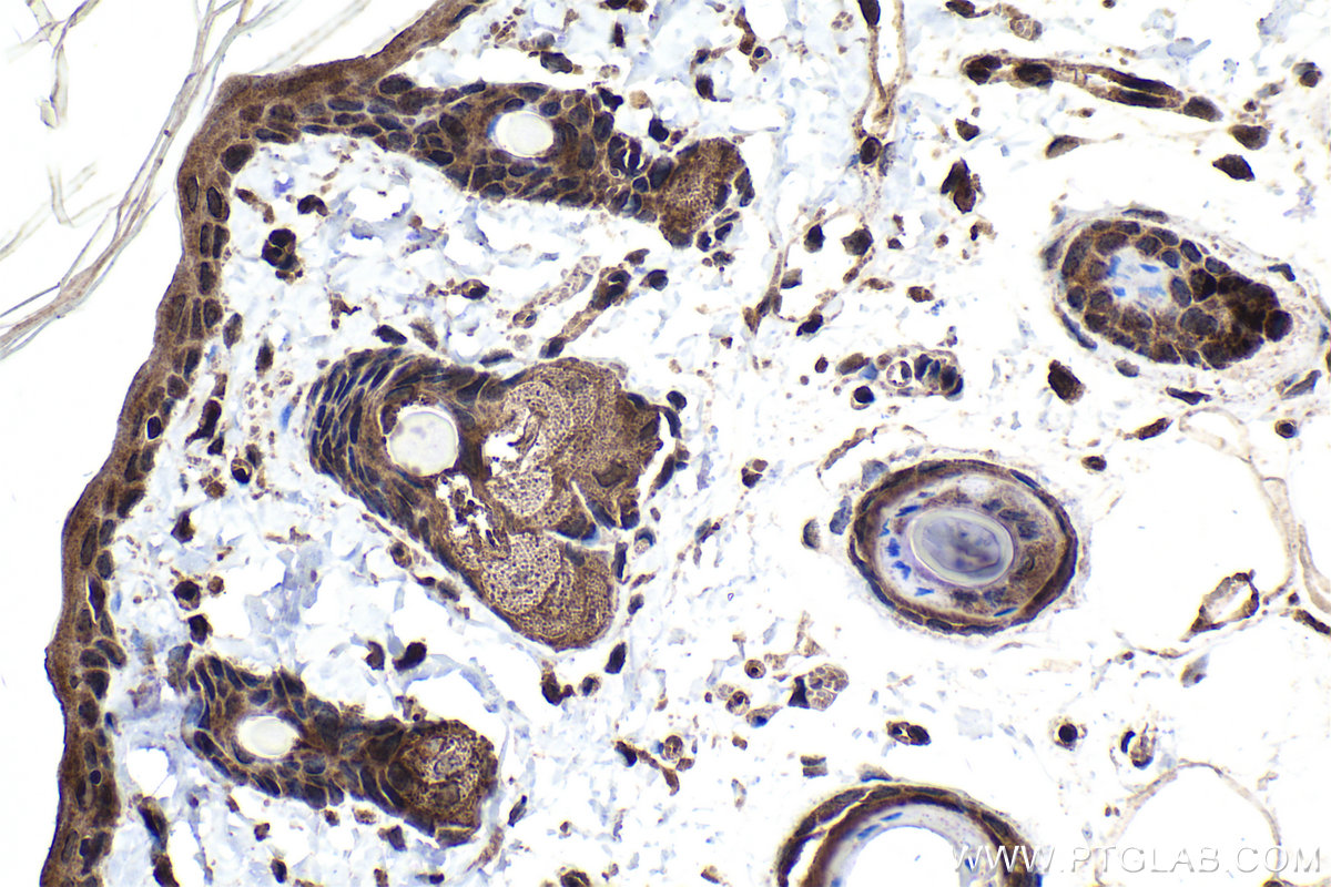 Immunohistochemical analysis of paraffin-embedded rat skin tissue slide using KHC1690 (ARHGEF5 IHC Kit).