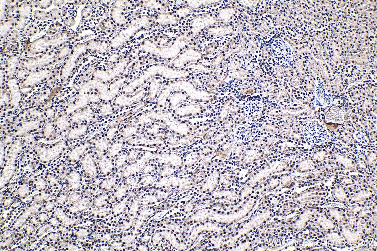 Immunohistochemical analysis of paraffin-embedded rat kidney tissue slide using KHC1329 (ARID1A IHC Kit).