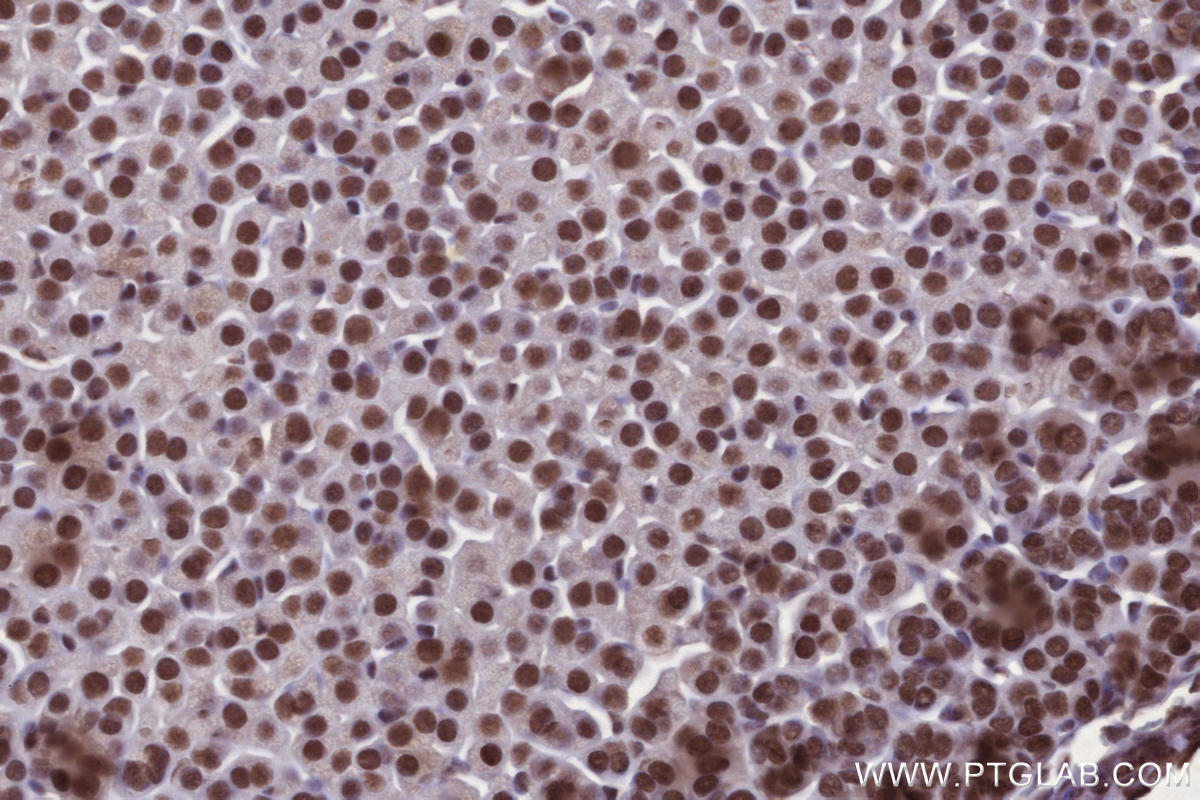 Immunohistochemical analysis of paraffin-embedded mouse adrenal gland tissue slide using KHC2695 (ARID1B IHC Kit).