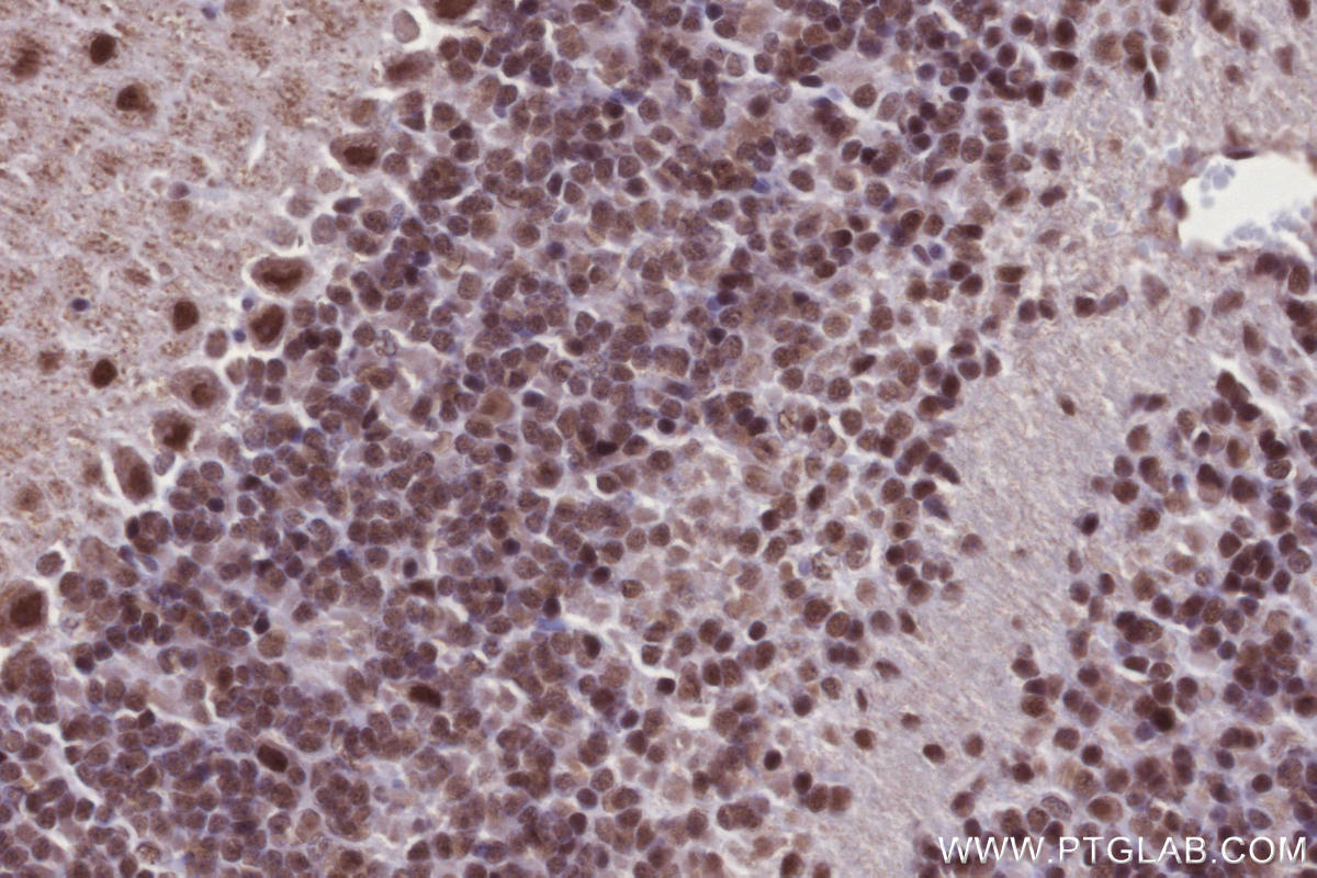 Immunohistochemical analysis of paraffin-embedded mouse cerebellum tissue slide using KHC2695 (ARID1B IHC Kit).