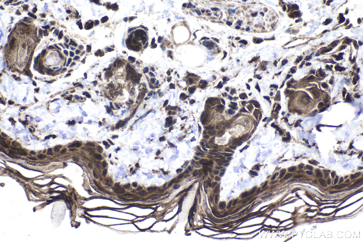 Immunohistochemical analysis of paraffin-embedded rat skin tissue slide using KHC1772 (ARID4B IHC Kit).