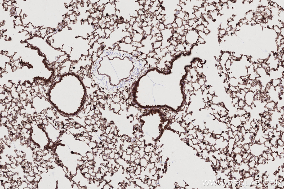 Immunohistochemical analysis of paraffin-embedded mouse lung tissue slide using KHC2779 (ARL8A/ARL8B IHC Kit).