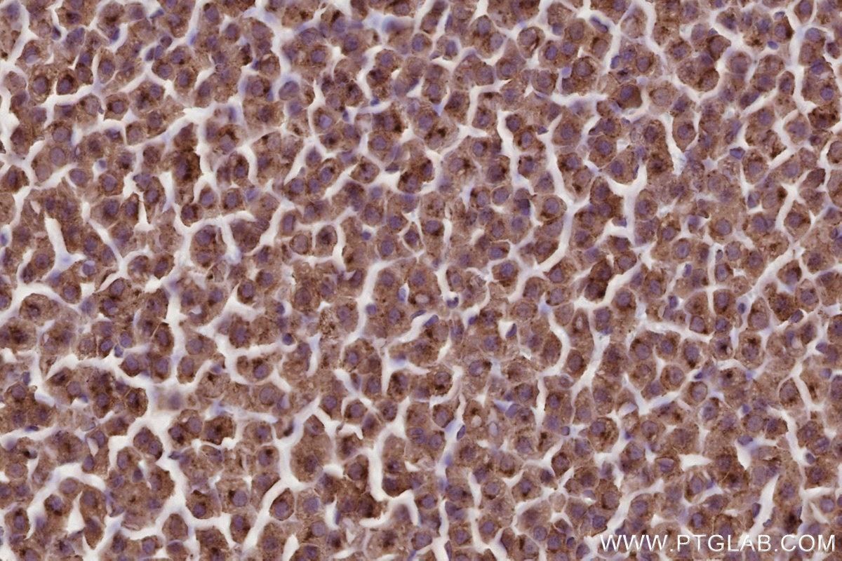 Immunohistochemical analysis of paraffin-embedded rat adrenal gland tissue slide using KHC2779 (ARL8A/ARL8B IHC Kit).