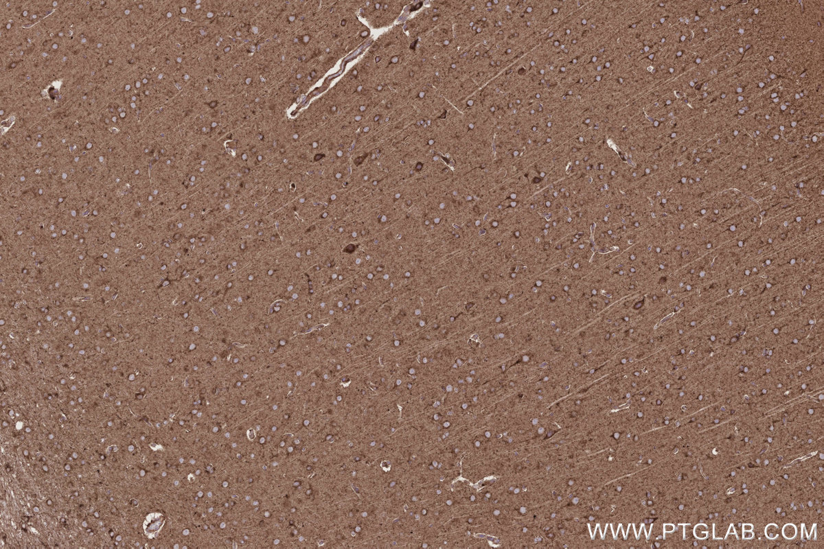 Immunohistochemical analysis of paraffin-embedded rat brain tissue slide using KHC2779 (ARL8A/ARL8B IHC Kit).