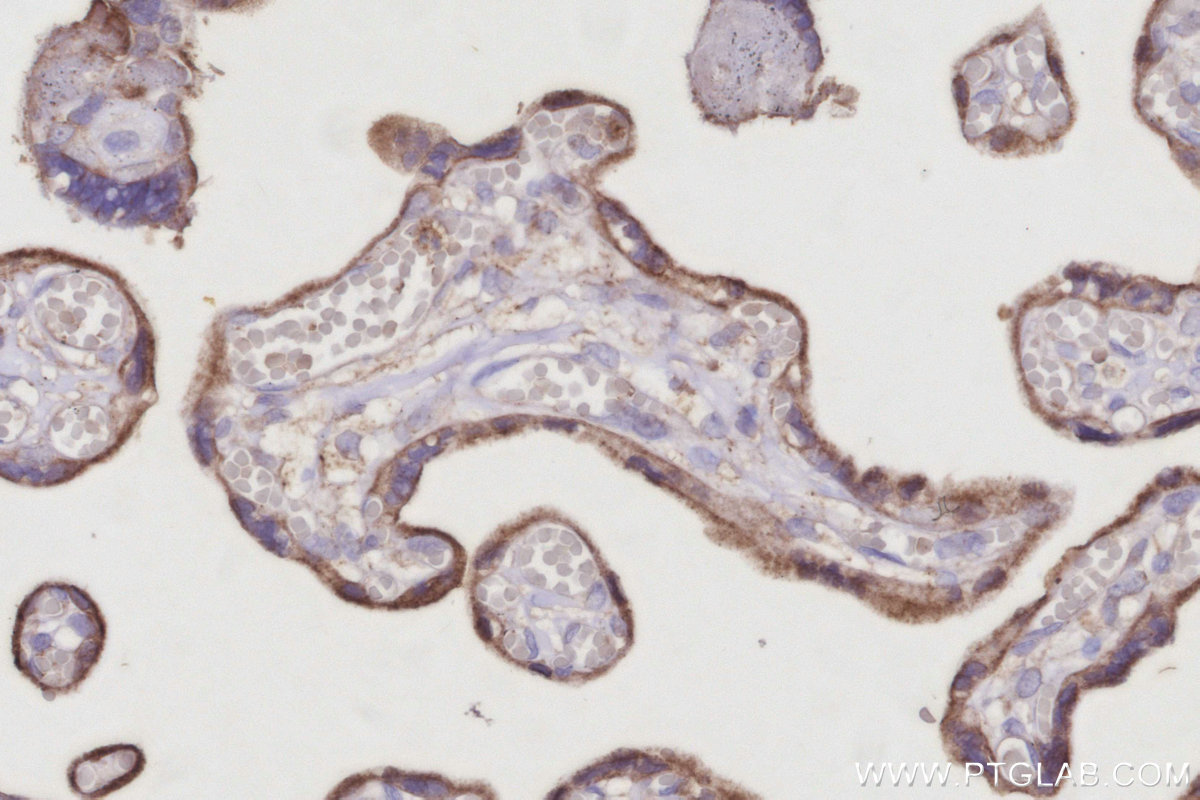 Immunohistochemical analysis of paraffin-embedded human placenta tissue slide using KHC2959 (ARL8B IHC Kit).