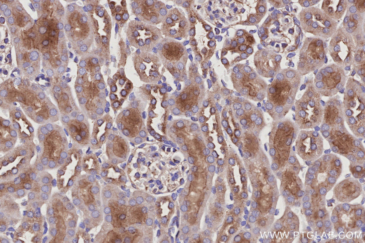 Immunohistochemical analysis of paraffin-embedded mouse kidney tissue slide using KHC2959 (ARL8B IHC Kit).