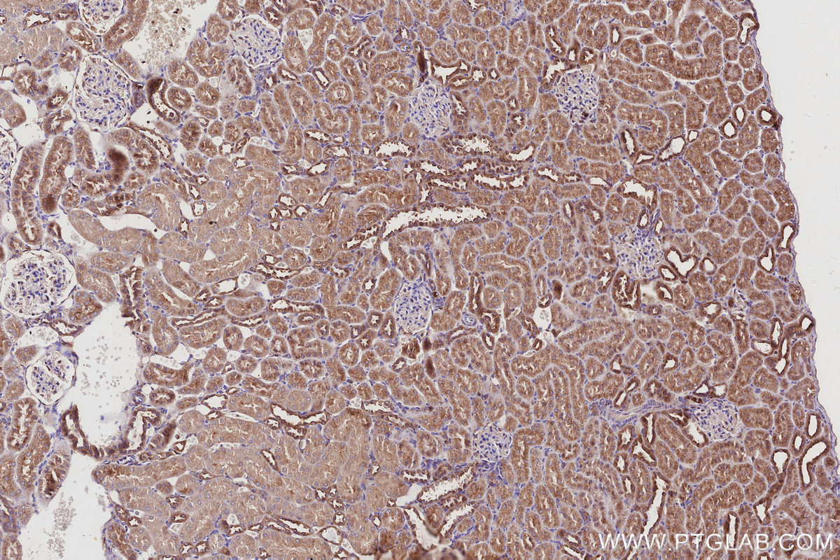 Immunohistochemical analysis of paraffin-embedded rat kidney tissue slide using KHC2959 (ARL8B IHC Kit).
