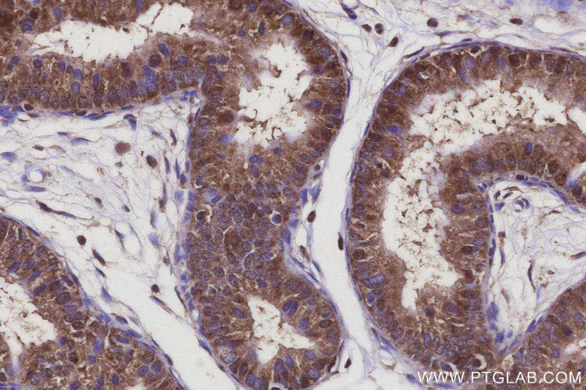 Immunohistochemical analysis of paraffin-embedded rat epididymis tissue slide using KHC3120 (ARMCX3 IHC Kit). Immunohistochemical analysis of paraffin-embedded rat epididymis tissue slide using KHC3120 (ARMCX3 IHC Kit).
