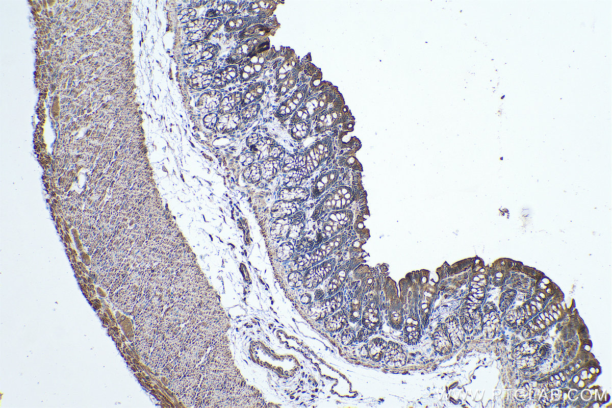 Immunohistochemical analysis of paraffin-embedded rat colon tissue slide using KHC0686 (ARMET IHC Kit).