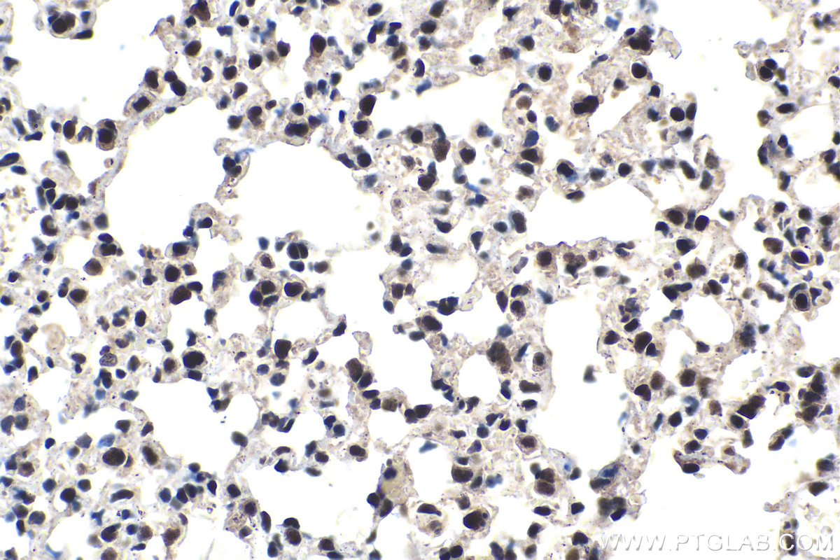 Immunohistochemical analysis of paraffin-embedded mouse lung tissue slide using KHC1568 (ARNT IHC Kit).