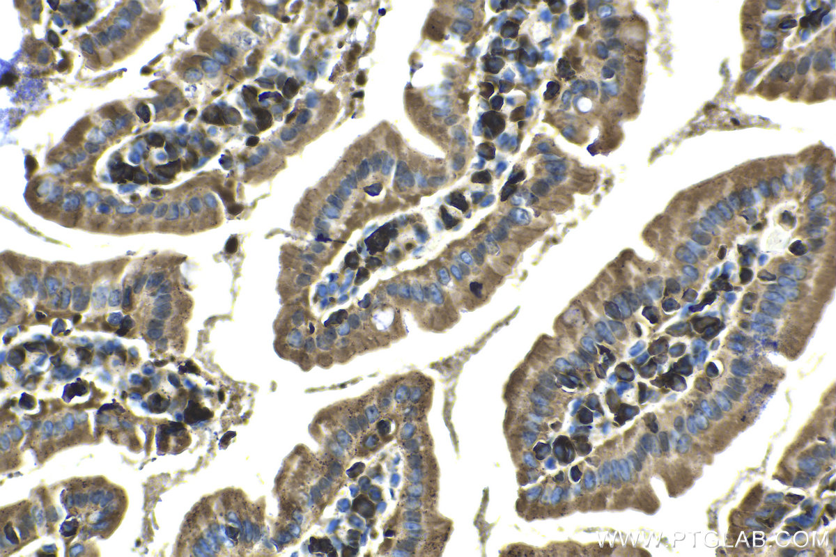 Immunohistochemical analysis of paraffin-embedded mouse small intestine tissue slide using KHC1434 (ARPC2 IHC Kit).