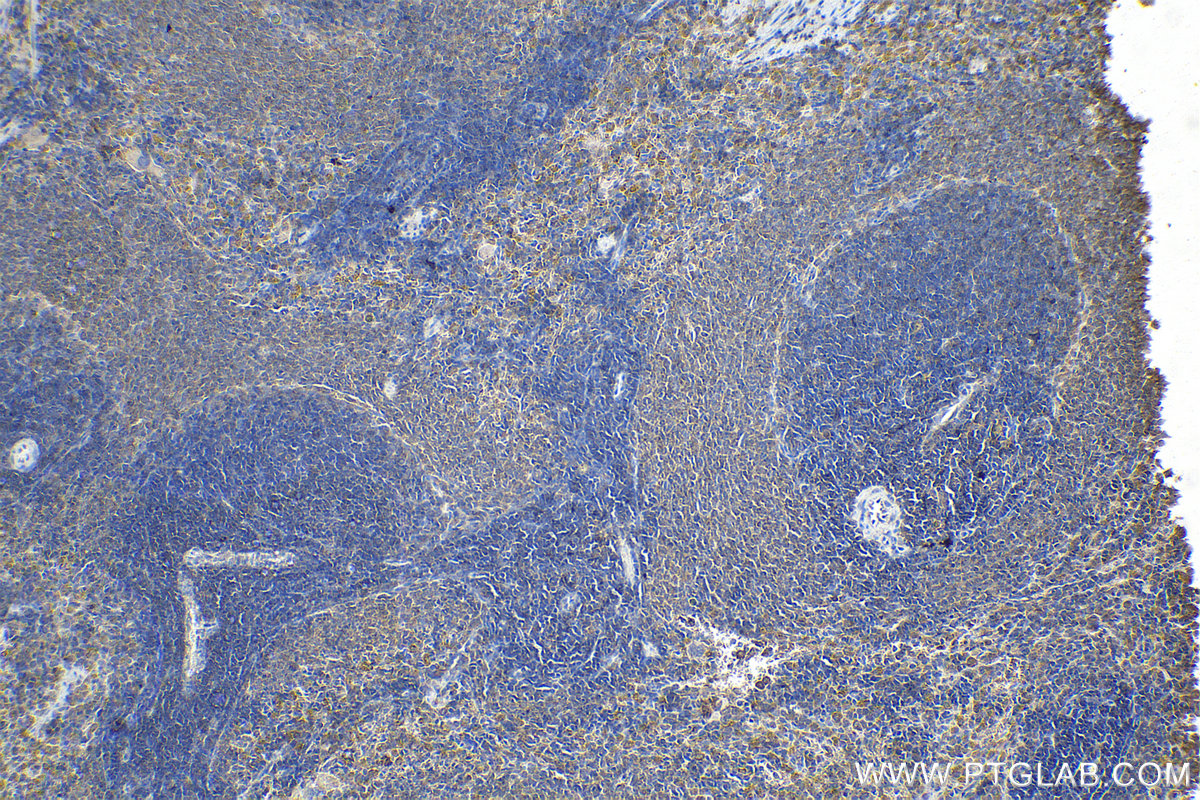 Immunohistochemical analysis of paraffin-embedded rat spleen tissue slide using KHC1636 (ARPC4 IHC Kit).