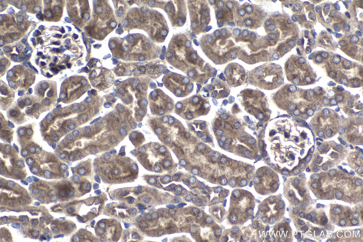 Immunohistochemical analysis of paraffin-embedded mouse kidney tissue slide using KHC1445 (ARPC5 IHC Kit).