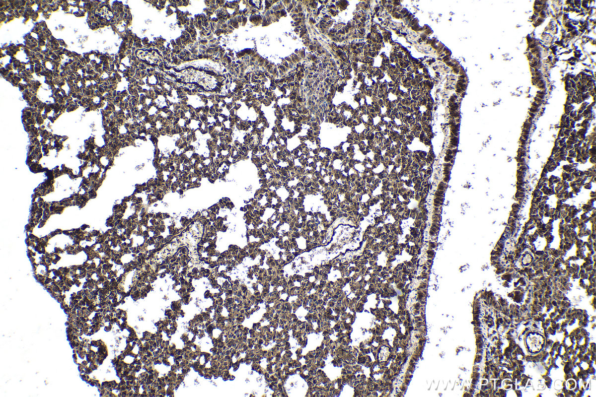 Immunohistochemical analysis of paraffin-embedded mouse lung tissue slide using KHC1612 (ARRB1 IHC Kit).
