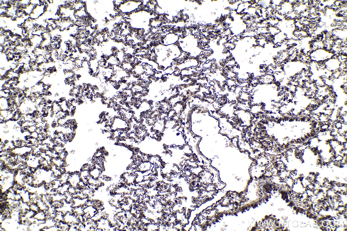 Immunohistochemical analysis of paraffin-embedded rat lung tissue slide using KHC1612 (ARRB1 IHC Kit).