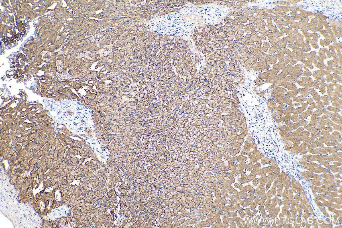 Immunohistochemical analysis of paraffin-embedded human liver tissue slide using KHC0385 (ASGR2 IHC Kit).