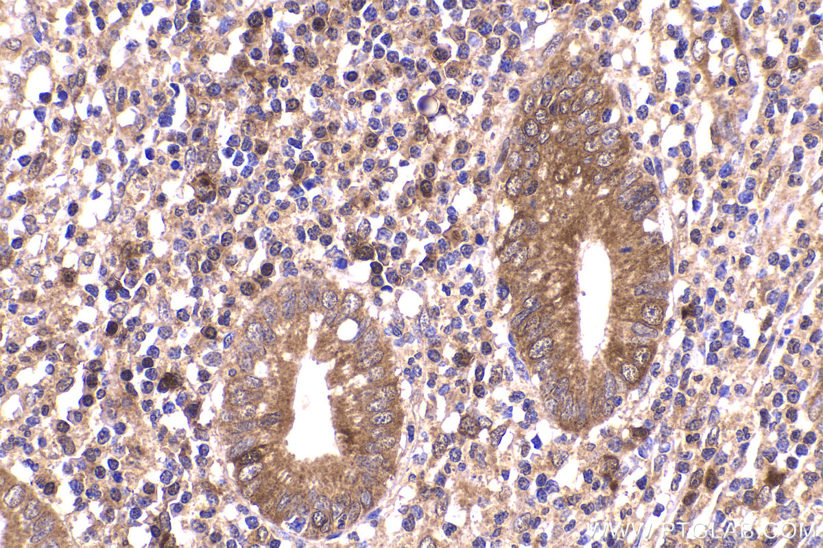 Immunohistochemical analysis of paraffin-embedded human appendicitis tissue slide using KHC2168 (ASNS IHC Kit).