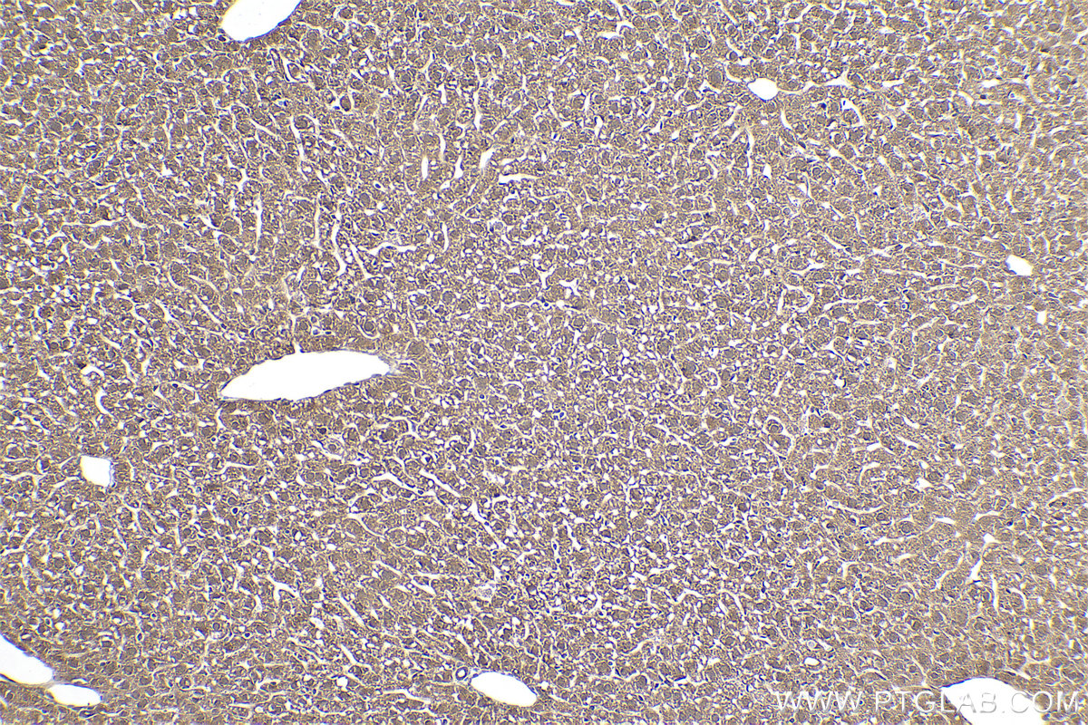 Immunohistochemical analysis of paraffin-embedded mouse liver tissue slide using KHC0400 (ASUN IHC Kit).