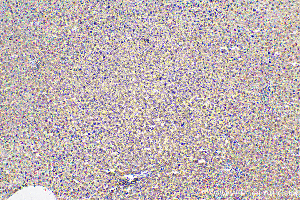 Immunohistochemical analysis of paraffin-embedded rat liver tissue slide using KHC0400 (ASUN IHC Kit).