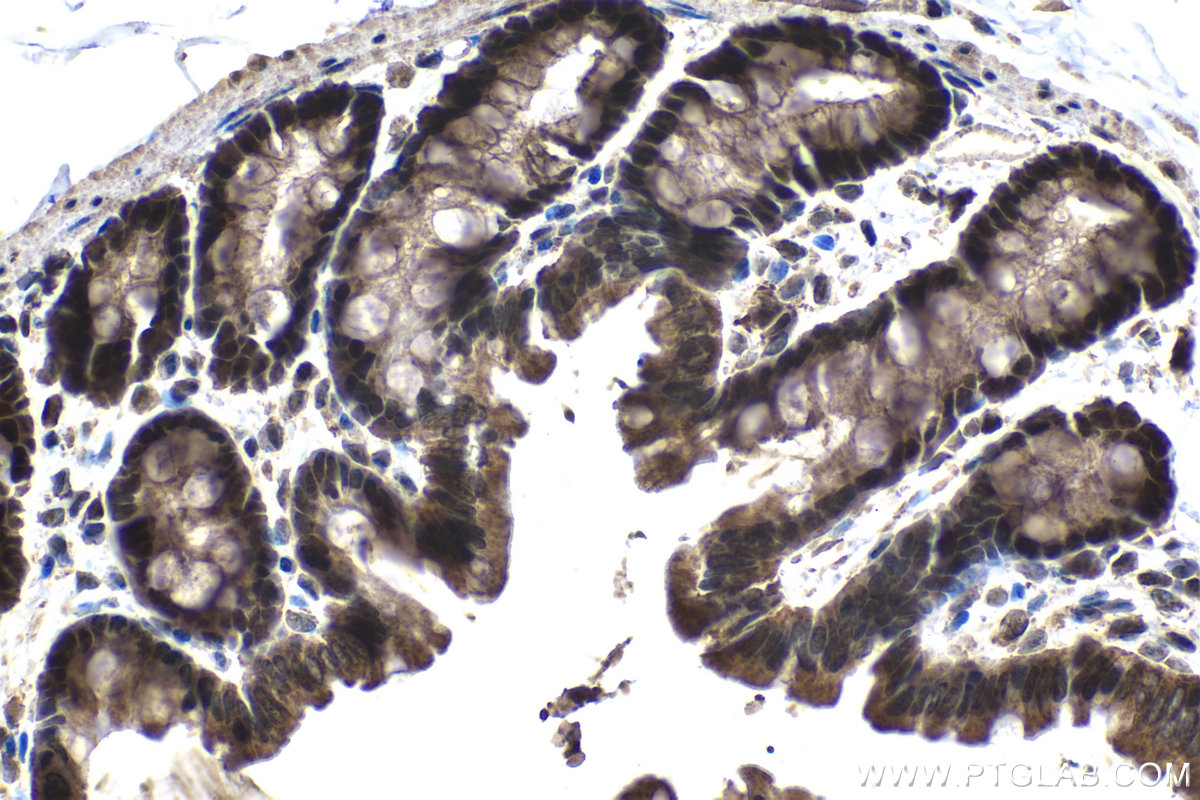 Immunohistochemical analysis of paraffin-embedded rat colon tissue slide using KHC1543 (ATF4 IHC Kit).