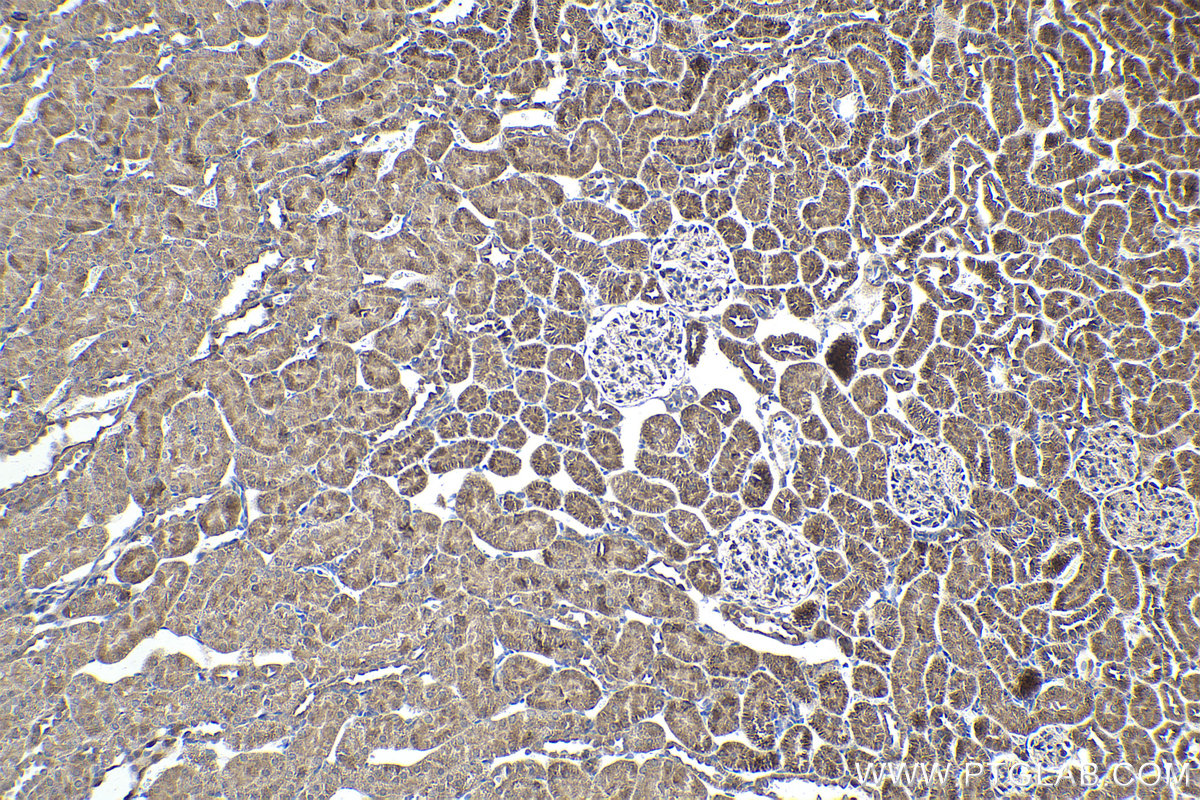 Immunohistochemical analysis of paraffin-embedded rat kidney tissue slide using KHC1899 (ATF6B IHC Kit).